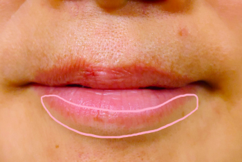 くすみのある唇のフチ。※メイクの色あり