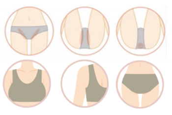 施術におすすめのVIO、バストトップ、脇など